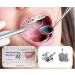 Braces Kit - 200pcs/Box Bondable Metal Brackets For Teeth 0.022 Slot With 3 Hook (Standard MBT) - Buy Online on GoSupps.com