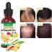 Ginger Oil 5-Pack for Hair Growth - Biotin Serum for Men & Women - Promotes Thicker & Healthier Hair - Hair Loss Treatment Included - Buy Online on GoSupps.com