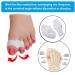 Reppkyh 8-Piece Bunion Corrector & Toe Separators | Soft Gel Spacer for Bunion & Overlapping Toe | 2 Loops Design | Effective Pain Relief - Buy Online on GoSupps.com