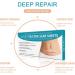 Silicone Scar Sheets for C-Section Surgery, Burn, Keloid, Acne - 4 Sheets (2 Month Supply) - Buy Online on GoSupps.com