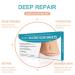 Reusable Silicone Scar Sheets for C-Section, Burn Injuries, Acne, Stretch Marks - 4 Pack - Buy Online on GoSupps.com
