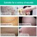 Scar & Stretch Mark Removal Cream - Skin Repair & Scar Repair Cream - Buy Online on GoSupps.com