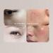 USB Portable Skin Analyzer Portable Skin Analyzer USB Facial Moisture Meter Skin Care Water Oil Tester Digital Moisture Sensor for Beauty Salon - Buy Online on GoSupps.com