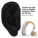 Acupuncture Ear Model Display | Human Ear Size for Centers - Shop Now! - Buy Online on GoSupps.com