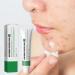 Anti Acne Face Cream Spot Cream for Acne Treatment and Spot Treatment with Nicotinamide Sodium Hyaluronate Aloe for Blackheads and Acne Prone Skin Reduces Spot Size Redness and Inflammation - Buy Online on GoSupps.com