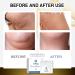 Superlimtm Essential Oils Nose Ring - Weight Loss & Detox - Ultra Thin Design (1 Box) - Buy Online on GoSupps.com