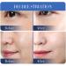 KARLOR Face Mask Anti-Wrinkle Face Mask Anti-Ageing Collagen Mask Collagen Reverse Film Mask with Yeast Extract Soluble Collagen Sheet Anti Ageing Mask Against Wrinkles (5 Pieces) - Buy Online on GoSupps.com