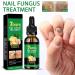  Cymwer Ginger Nail Serum 30ml Natural Growth Oil Strengthener for Fortified Nails Moisturizing and Revitalizing Care - Buy Online on GoSupps.com