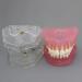 Samnuerly 28 Removable Teeth Dental Implant Model - Translucent Standard for Research & Teaching - Ideal for Removable Lower Jaw - Buy Online on GoSupps.com