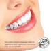 Fsetnight 10Pcs Oral Teeth Gems | Crystal Tooth Jewelry & Clear Color Dental Decor - Buy Online on GoSupps.com