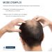 Hair Growth Oil Nutrient Hair Supplement | Multifunctional Scalp Massage Daily Care Accessory for Women - Buy Online on GoSupps.com