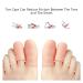 8 Pairs of Silicone Big Toe Caps | Toe Protection for Corns & Blisters | Pain Relief & Ingrown Toenail Care - Buy Online on GoSupps.com