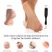 Pumice Stone Foot Scrubber with Handle - Callus Remover for Dry Dead Skin - Exfoliating Brush for Heels, Elbows & Hands - Buy Online on GoSupps.com