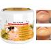 Bee Venoms Repair Cream Spots Removal Cream Bee Venoms Skin Tag Remover Hydrating Moisturizing Cream for All Skin - Buy Online on GoSupps.com