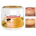 Fizepgo Spots Removal Cream | Bee Venoms Repair Cream | Mild Anti-Age Hydrating Moisturizing Cream | Bee Venoms Skin Tag Remover - Hydrating Moisturizing Cream For All Skin