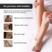 Snow Bleach Private Area Lightening Cream Body Bleaching Cream Snow Bleach Cream For Private Area Lightening And Anti-Black Cream For Skin Dark Remover For Dark Skin (1pc) - Buy Online on GoSupps.com