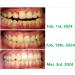 Convenient Gum Protection Pellets & Portable Toothpaste Tablets - Natural Travel Mouthwash Powder for Fresh Breath (Lemon) - Best Oral Care Solutions - Buy Online on GoSupps.com