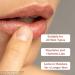 Medical-Grade Lanolin Lip Balm with Natural Vanilla & Monk Fruit - Hydrating & Soothing for All Skin Types - International Shipping Available - Buy Online on GoSupps.com