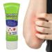Itch Relief Balm 20g - Moisturizing Anti-Itch Cream for Dry Skin, External Skin Protectant - Buy Online on GoSupps.com