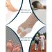 Silicone Toe Correctors & Relief for Hallux Valgus - Hammer Toe Separator & Spacer - International Shipping Available - Buy Online on GoSupps.com