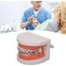 Tooth Demonstration Model - Dental Typodont with Orthodontic Bracket for Dentist Research | International Shipping - Buy Online on GoSupps.com