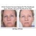 AGE Control Dual Treatment Anti Glycation Serum - Look 8-10 Years Younger in 60 Days | Reduce Dark Spots Lift Firm Brighten & Hydrate | Non-Greasy Anti-Wrinkle Solution - Buy Online on GoSupps.com
