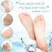 Shop Callus Socks & Foot Masks - Effective Callus Remover & Foot Care Set for Smooth Feet - International Shipping Available - Buy Online on GoSupps.com