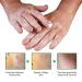 Vitiligo Care Set: Fix Revitalize Elixir & Soothing Moisturizer Cream - Reduce White Spots on Body - 2pcs - Buy Online on GoSupps.com