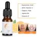 Natudeco 10ml Vitamin C Serum Whitening Face Essence Moisturizing Serum Skin Care Treatment for Facial Firming Hydrating Whitening Skin Dark Spot Remover - Buy Online on GoSupps.com