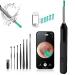 OKUBOX Ear Wax Removal Ear Cleaner with 1080P Camera Smart Visual Earwax Cleaning Tool with 6 LED Lights 8 Pcs Ear Set 6 Ear Scoop Ear Tips Replacement Ear Cleaner for iOS & Android (NE6-YT)