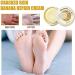 Cr me anti-d chirure pour peau d'hiver R paration Main Pied Se Soucier Exfoliant Cr me Anti Engelures Sec Fissures Et Fissures Gu rir Pommade Cr mes Pieds Anti-Crevasses - Buy Online on GoSupps.com