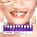 Sensitive Teeth Whitening Kit - Professional Tooth Whitener with 14 Peppermint Strips - Buy Online on GoSupps.com