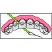 I Dontix Brace X-Floss Green - Easy-to-Use Dental Floss for Efficient Cleaning - Buy Online on GoSupps.com