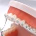 RZJZGZ Clear Orthodontic Power Chains Brace - Long Elastic Rubber Bands - Buy Online on GoSupps.com