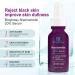 20% Niacinamide Serum | Vitamin B3 Anti-Aging Moisturizer & Pore Minimizer | 30ml Concentrated Treatment - Buy Online on GoSupps.com