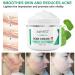 Scar Removal Cream for Old Scars, Stretch Marks & Burns - Natural Skin Repair for Acne Scars & Spots - Buy Online on GoSupps.com