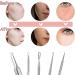 vgggrd Blackhead Remover Comedone Squeezer Set Professional Pimple Tool Tweezers Set with Metal Box Acne Whiteheads Blackhead Remover for All Skin Types - Buy Online on GoSupps.com