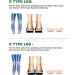 Orthopedic O/X Type Leg Corrective Heel Wedge & Inserts - Gel Pads for Bowlegs Knock Knees & Foot Alignment - International Shipping Available - Buy Online on GoSupps.com