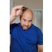 Buy Dubbly Dual Headed Razor & 10 Blades - Cut Shave Time in Half No Irritation - Buy Online on GoSupps.com