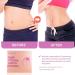 Genovie MD Tight Tummy Patch Body Contouring Applicator - Beige - Buy Online on GoSupps.com