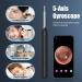 1080P Otoscope Camera Ear Wax Removal Tool for iOS & Android Black - Buy Online on GoSupps.com