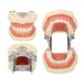 Buy Dental Typodont Teeth Model - 28 Teeth Soft Gums Upper Jaw Cyst Teaching Model for Incision Practice - International Shipping Available - Buy Online on GoSupps.com