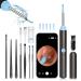 Ear Wax Removal Tool  Ear Wax Cleaner with 1296P HD Waterproof Camera  Ear Wax Removal Kit with 8 Pcs Ear Set  Otoscope Cleaner for iPhone  iPad  Android (Black)