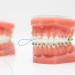 Floss Threaders for Braces, Bridges, and Implants - 450 Count (3 Pack) - Dental Flossing Tool - Buy Online on GoSupps.com