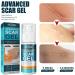 PLGEBR Fade Scar Cream Gel - Postpartum Stretch Marks & Burn Scar Treatment - Buy Online on GoSupps.com