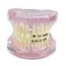 Dental teeth model demo transparent dental implant disease teeth model with metal ceramic self-league bracket teeth of orthodontic retainer demonstration model