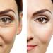 High Strength Retinol Moisturizer Cream for Face and Eye Area - 2.5% Retinol, Hyaluronic Acid, Vitamin E, Green Tea - Anti-Aging Formula for Wrinkles, Fine Lines, Spots - Day and Night - Buy Online on GoSupps.com