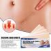 Professional Silicone Scar Removal Sheets - Breathable & Waterproof - 4 Reusable Gel Strips for Lightening Scars - Skin Color, Invisible Tape (7.5*4cm) - Buy Online on GoSupps.com