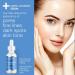 Niacinamide 11% + Zinc 1.5% Serum | Reduce Pores Improve Skin Texture & Radiance | 1 fl oz - International Shipping - Buy Online on GoSupps.com
