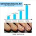 Ingrown Toenail Correction Patch - 50PCS Sticker & 4PCS Tool Set for Foot Care Treatment - Buy Online on GoSupps.com